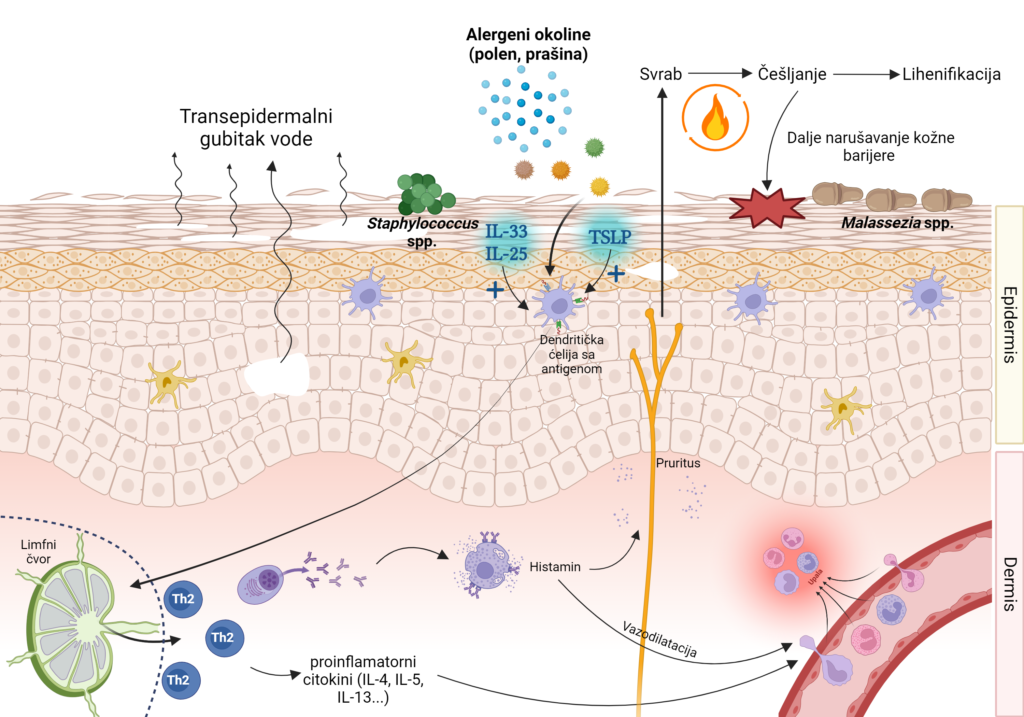 Atopic dermatitis_pathogenesis (Created in Biorender)